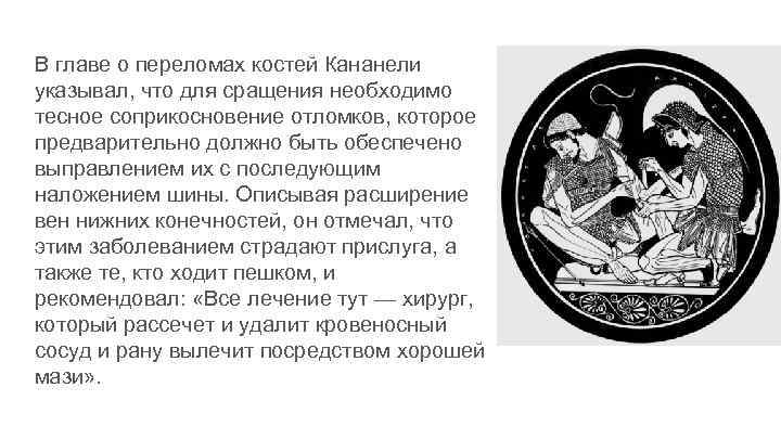 В главе о переломах костей Кананели указывал, что для сращения необходимо тесное соприкосновение отломков,