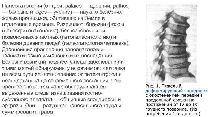 Палеопатология (от греч. palaios — древний, pathos — болезнь и logos— учение) — наука