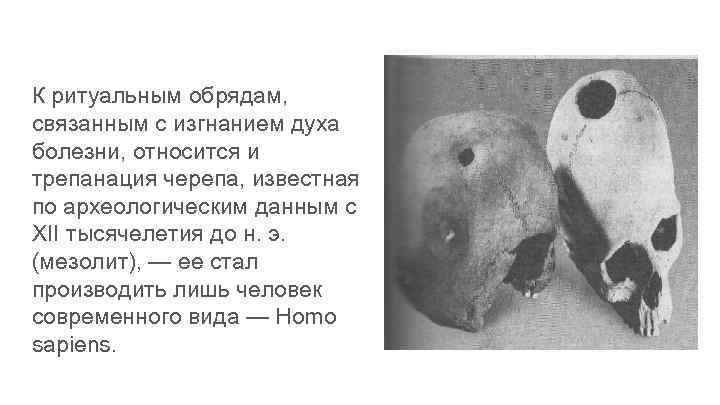 К ритуальным обрядам, связанным с изгнанием духа болезни, относится и трепанация черепа, известная по