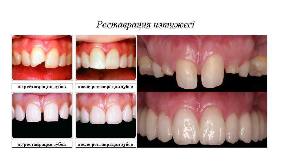 Реставрация нәтижесі 