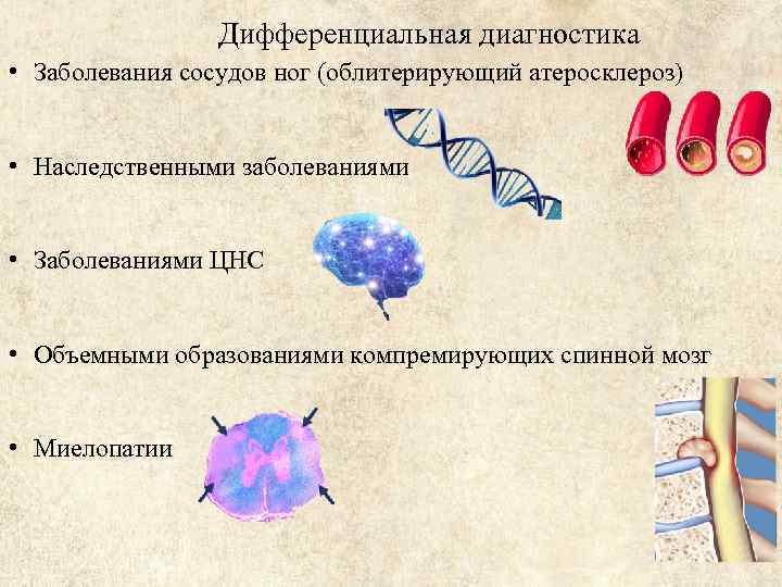 Дифференциальная диагностика • Заболевания сосудов ног (облитерирующий атеросклероз) • Наследственными заболеваниями • Заболеваниями ЦНС