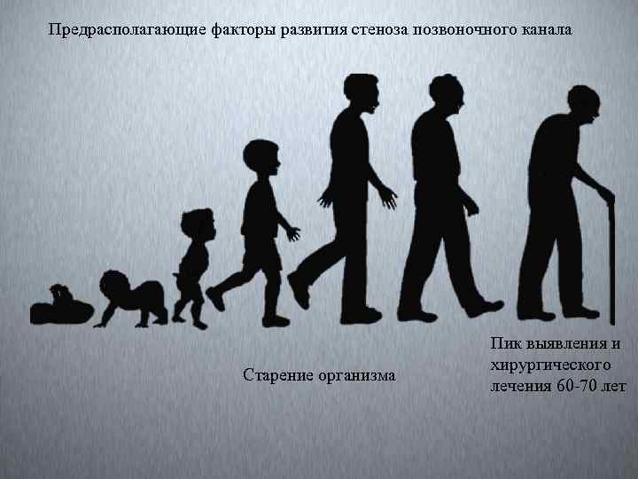 Предрасполагающие факторы развития стеноза позвоночного канала Старение организма Пик выявления и хирургического лечения 60