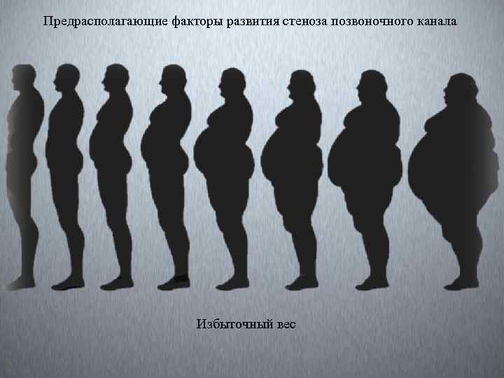 Предрасполагающие факторы развития стеноза позвоночного канала Избыточный вес 