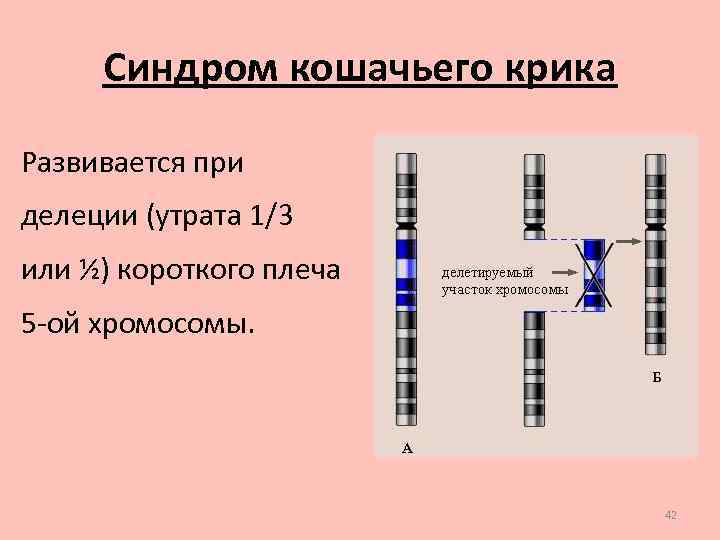 Удвоение участка хромосомы какая мутация. Синдром кошачьего крика (делеция в 5-Ой хромосоме);. Делеция хромосомы. Делеция это в генетике. Дупликация хромосом.