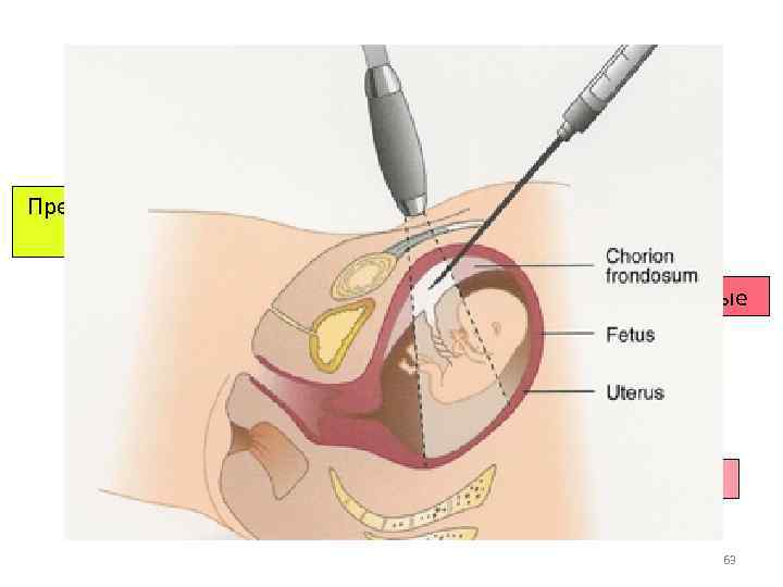 Определение генетического статуса плода Пренатальные Предимплантационные (ЭКО) Инвазивные Биопсия Неинвазивные УЗИ+БХ крови NIPT 63
