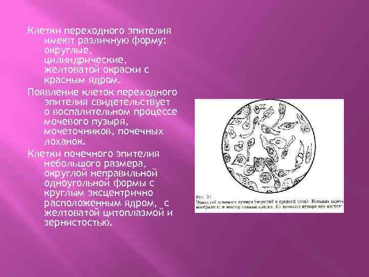 Клетки переходного эпителия имеют различную форму: округлые, цилиндрические, желтоватой окраски с красным ядром. Появление