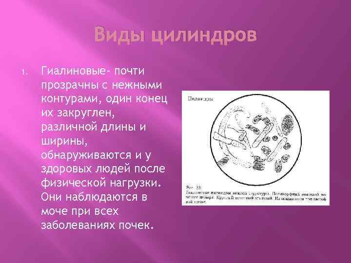 Виды цилиндров 1. Гиалиновые- почти прозрачны с нежными контурами, один конец их закруглен, различной