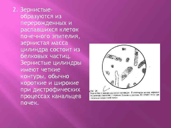 2. Зернистыеобразуются из перерожденных и распавшихся клеток почечного эпителия, зернистая масса цилиндра состоит из