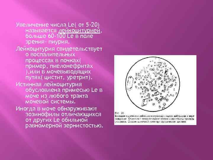 Увеличение числа Le( от 5 -20) называется лейкоцитурией, больше 60 -100 Le в поле