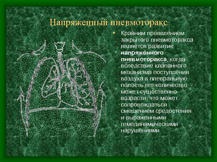 Напряженный пневмоторакс • Крайним проявлением закрытого пневмоторакса является развитие напряженного пневмоторакса, когда вследствие клапанного