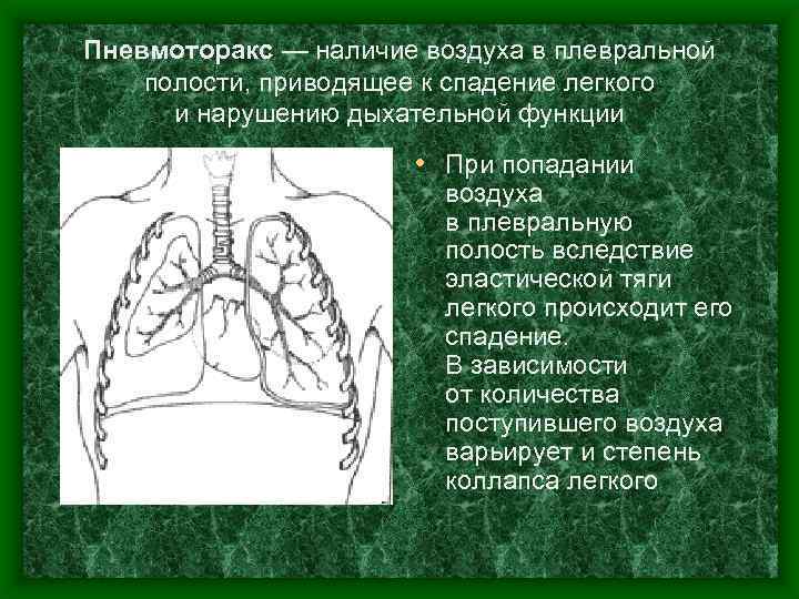 Пневмоторакс — наличие воздуха в плевральной полости, приводящее к спадение легкого и нарушению дыхательной