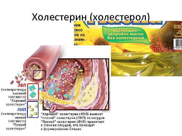 Холестерин (холестерол) 