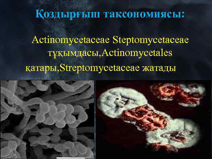 Қоздырғыш таксономиясы: Actinomycetaceae Steptomycetaceae тұқымдасы, Actinomycetales қатары, Streptomycetaceae жатады 