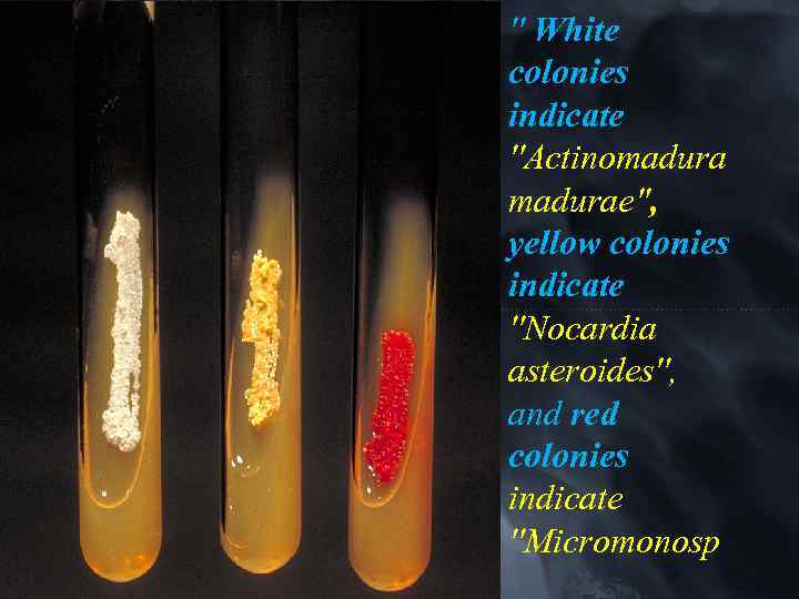 '' White colonies indicate ''Actinomadurae'', yellow colonies indicate ''Nocardia asteroides'', and red colonies indicate