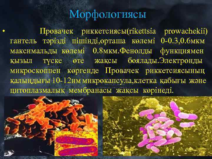 Морфологиясы • Провачек риккетсиясы(rikettsia prowachekii) гантель тәрізді пішінді, орташа көлемі 0 -0. 3, 0.