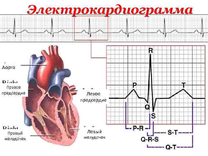 Электрокардиограмма Аорта Правое предсердие Правый желудочек Левое предсердие Левый желудочек 