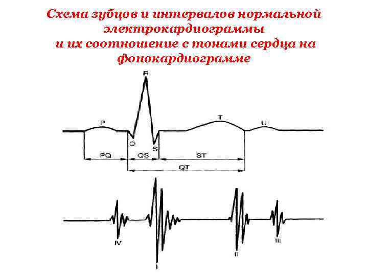 Схема зубцов и интервалов нормальной электрокардиограммы и их соотношение с тонами сердца на фонокардиограмме