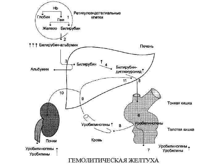 ГЕМОЛИТИЧЕСКАЯ ЖЕЛТУХА 