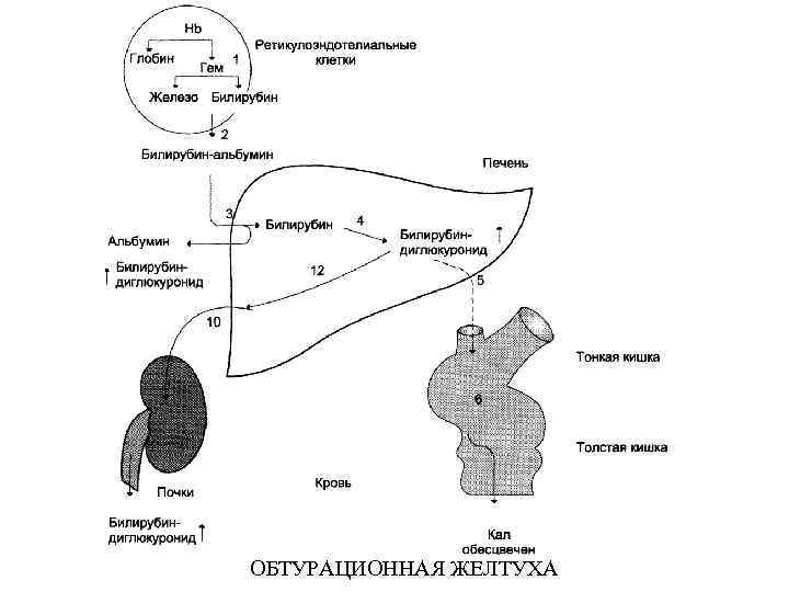 ОБТУРАЦИОННАЯ ЖЕЛТУХА 