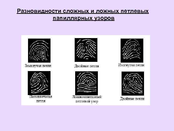 Разновидности сложных и ложных петлевых папиллярных узоров 