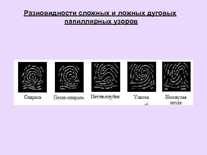 Разновидности сложных и ложных дуговых папиллярных узоров 