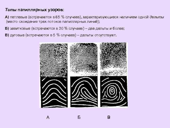 Типы папиллярных узоров: А) петлевые (встречаются в 65 % случаев), характеризующиеся наличием одной дельты