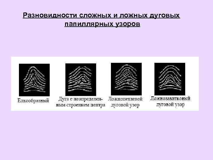 Разновидности сложных и ложных дуговых папиллярных узоров 