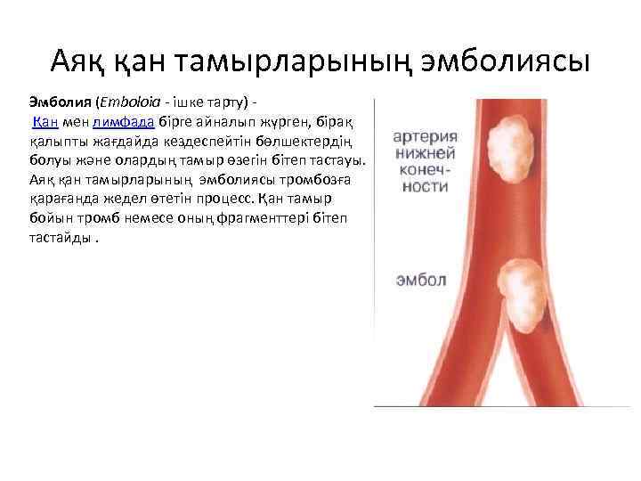 Аяқ қан тамырларының эмболиясы Эмболия (Еmboloia - ішке тарту) Қан мен лимфада бірге айналып