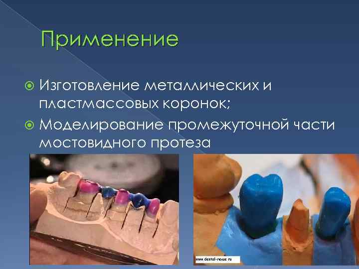 Части мостовидного протеза. Моделирование промежуточной части мостовидного протеза. Моделировка мостовидного протеза из воска промежуточной части. Моделировка мостовидного проте. Моделирование мостовидного протеза.