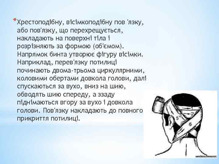 *Хрестоподібну, вісімкоподібну пов 'язку, або пов'язку, що перехрещується, накладають на поверхні тіла і розрізняють