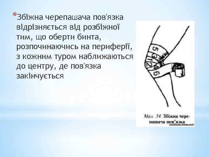 *Збіжна черепашача пов'язка відрізняється від розбіжної тим, що оберти бинта, розпочинаючись на периферії, з