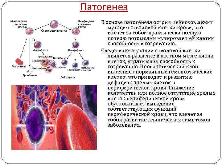 Патогенез В основе патогенеза острых лейкозов лежит мутация стволовой клетки крови, что влечет за
