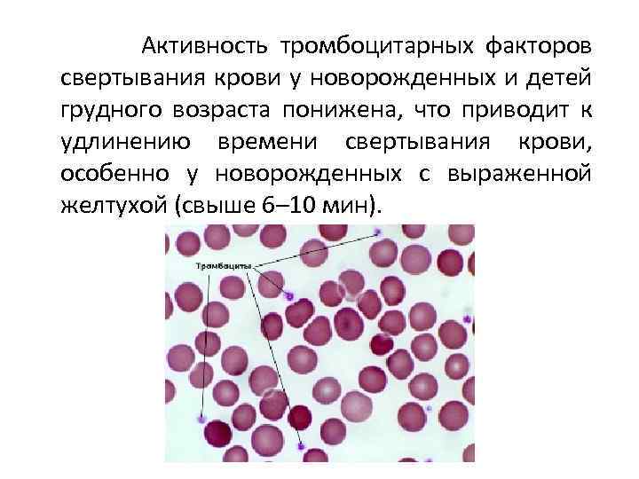  Активность тромбоцитарных факторов свертывания крови у новорожденных и детей грудного возраста понижена, что