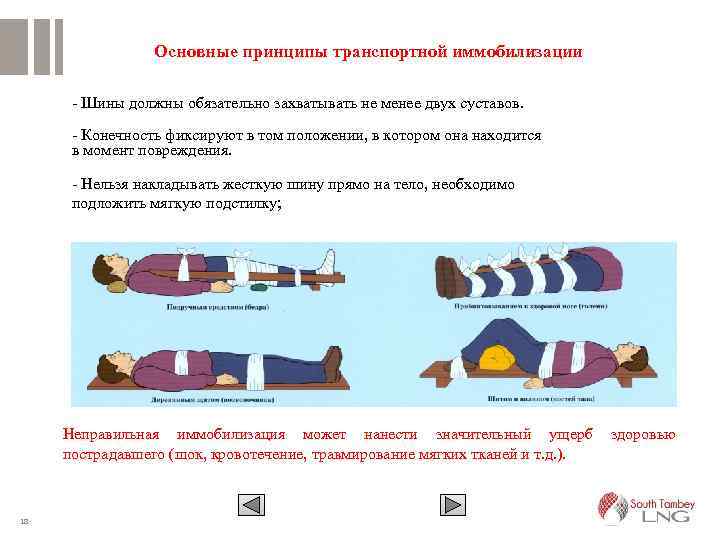 Основные принципы транспортной иммобилизации Шины должны обязательно захватывать не менее двух суставов. Конечность фиксируют