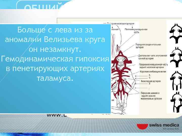 ОБЩИЙ ОБЗОР ПРОБЛЕМЫ РАССЕЯННОГО СКЛЕРОЗА Больше с лева из за аномалии Велизьева круга он