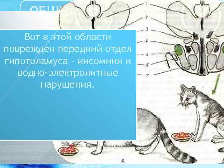 ОБЩИЙ ОБЗОР ПРОБЛЕМЫ РАССЕЯННОГО СКЛЕРОЗА Вот в этой области поврежден передний отдел гипотоламуса -