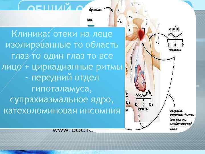 ОБЩИЙ ОБЗОР ПРОБЛЕМЫ РАССЕЯННОГО СКЛЕРОЗА Клиника: отеки на леце изолированные то область глаз то