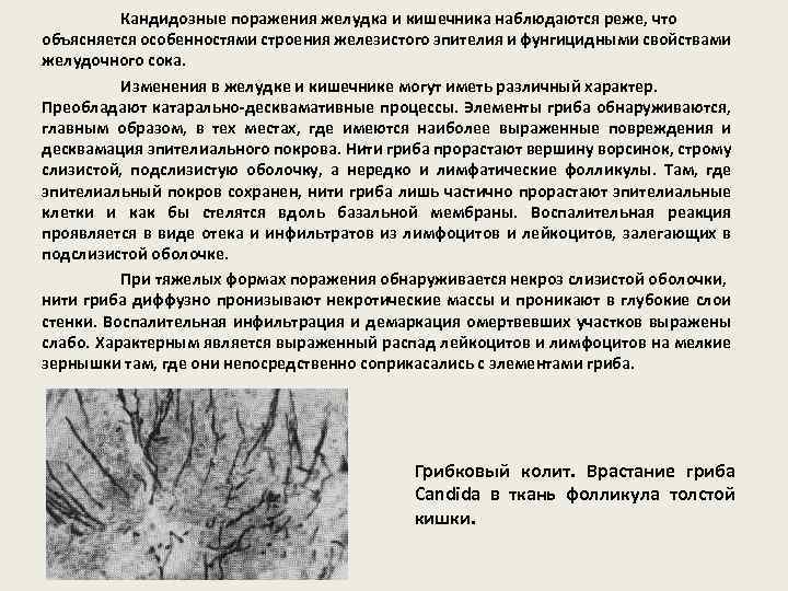 Кандидозные поражения желудка и кишечника наблюдаются реже, что объясняется особенностями строения железистого эпителия и