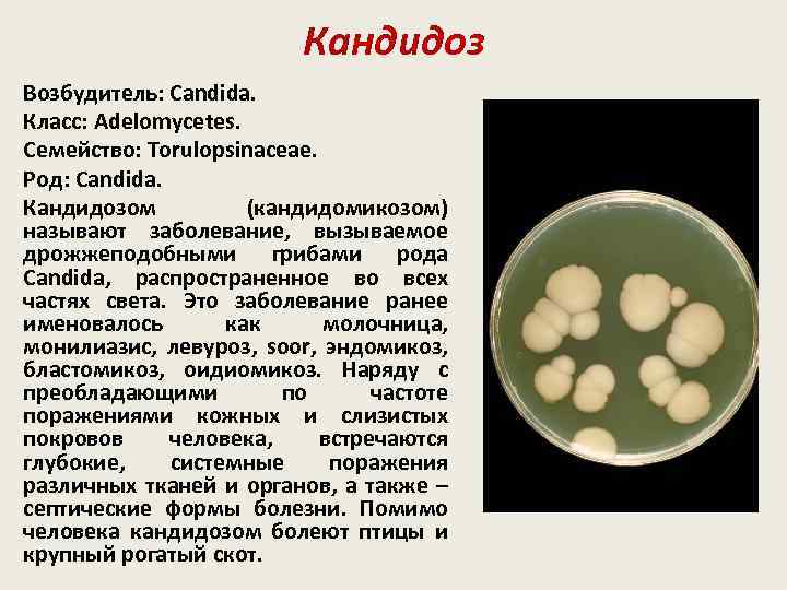 Кандидоз Возбудитель: Candida. Класс: Adelomycetes. Семейство: Torulopsinaceae. Род: Candida. Кандидозом (кандидомикозом) называют заболевание, вызываемое
