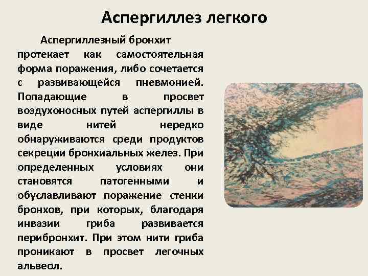 Аспергиллез легкого Аспергиллезный бронхит протекает как самостоятельная форма поражения, либо сочетается с развивающейся пневмонией.
