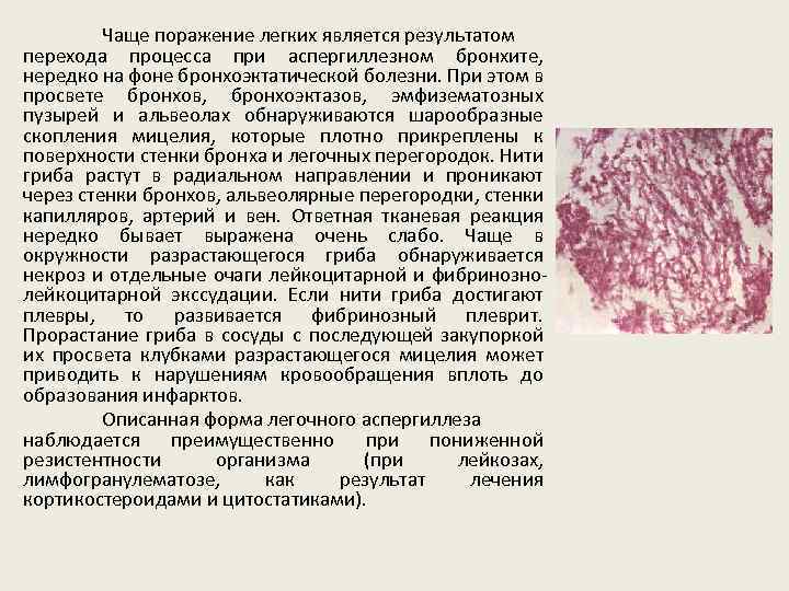 Чаще поражение легких является результатом перехода процесса при аспергиллезном бронхите, нередко на фоне бронхоэктатической