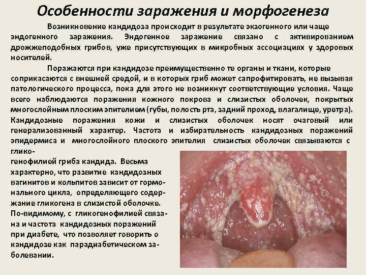 Особенности заражения и морфогенеза Возникновение кандидоза происходит в результате экзогенного или чаще эндогенного заражения.