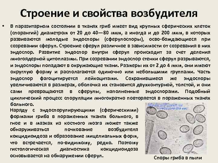 Строение и свойства возбудителя • В паразитарном состоянии в тканях гриб имеет вид крупных