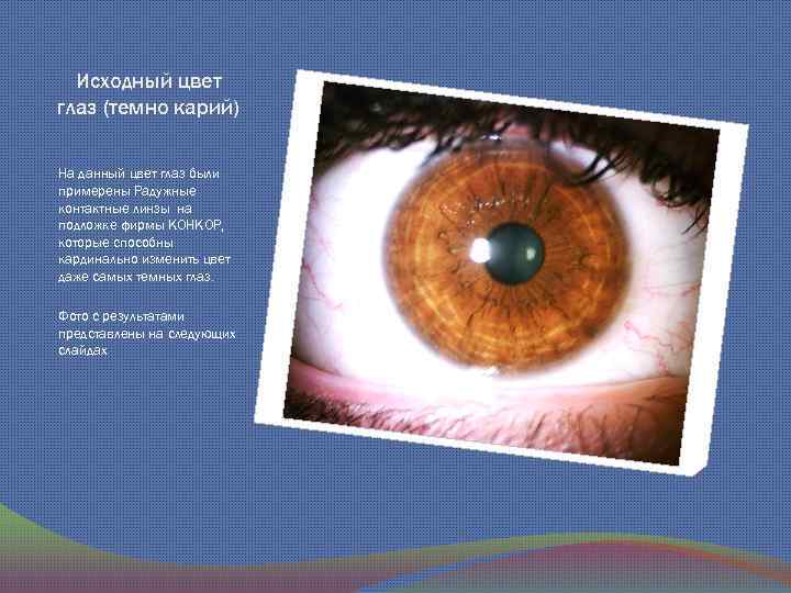 Исходный цвет глаз (темно карий) На данный цвет глаз были примерены Радужные контактные линзы