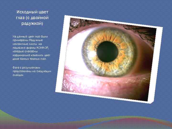 Исходный цвет глаз (с двойной радужкой) На данный цвет глаз были примерены Радужные контактные