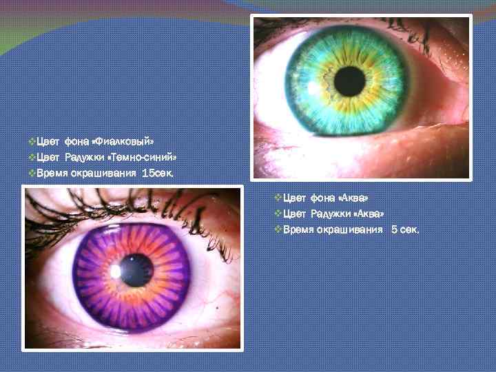 v. Цвет фона «Фиалковый» v. Цвет Радужки «Темно-синий» v. Время окрашивания 15 сек. v.