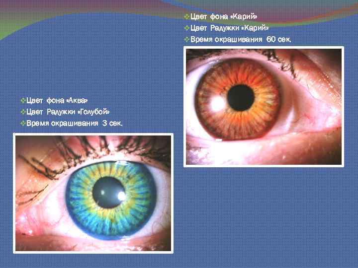 v. Цвет фона «Карий» v. Цвет Радужки «Карий» v. Время окрашивания 60 сек. v.