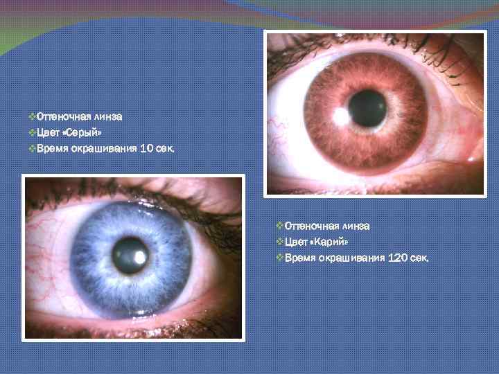v. Оттеночная линза v. Цвет «Серый» v. Время окрашивания 10 сек. v. Оттеночная линза