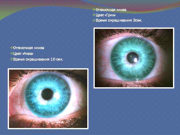 v. Оттеночная линза v. Цвет «Грин» v. Время окрашивания 3 сек. v. Оттеночная линза