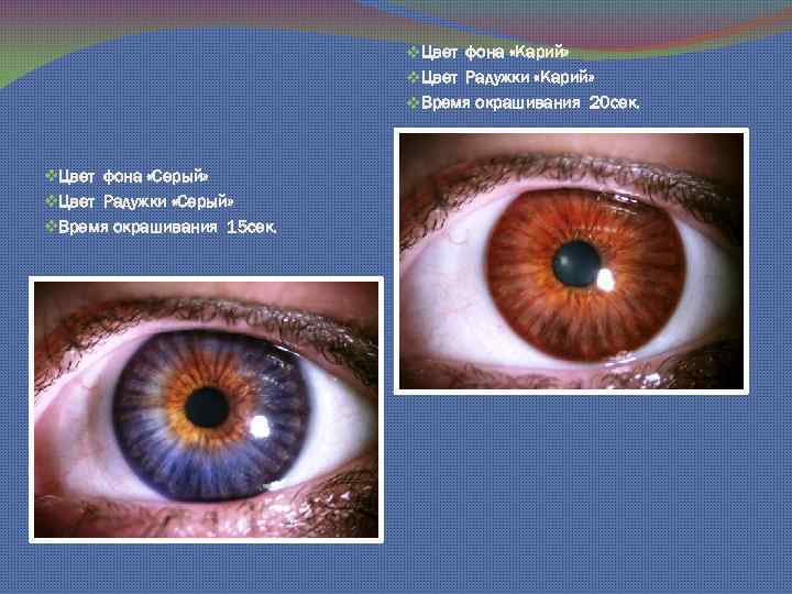 v. Цвет фона «Карий» v. Цвет Радужки «Карий» v. Время окрашивания 20 сек. v.